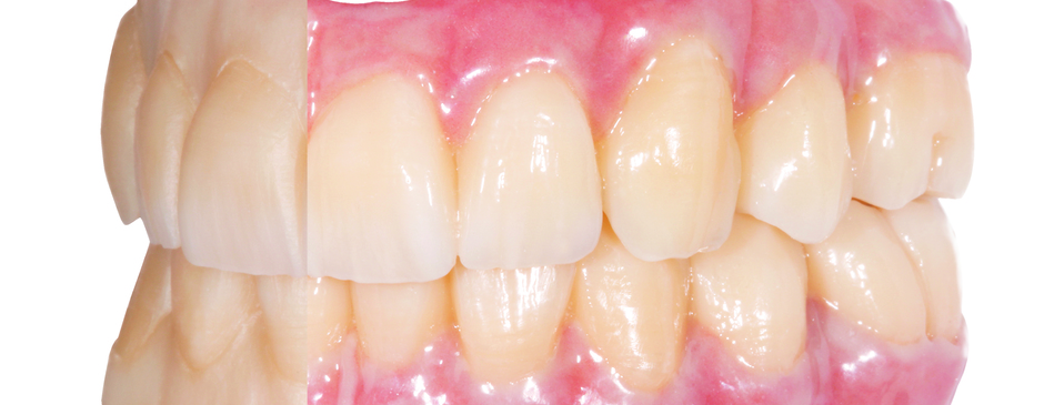 Ceramotion OneTouch Pink